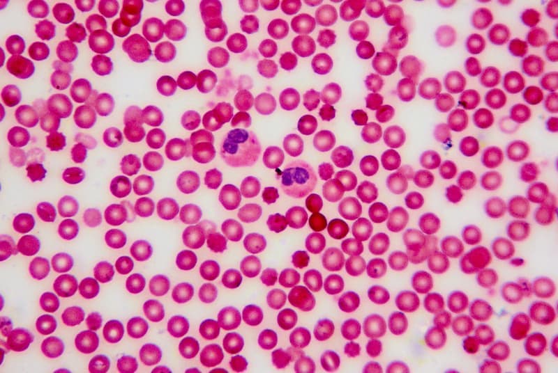 Microbioma nel sangue: un concetto innovativo