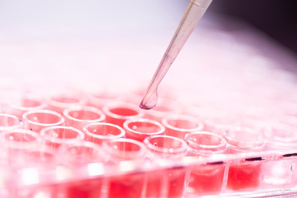 L’attività delle cellule mesenchimali stromali e i farmaci cellulari