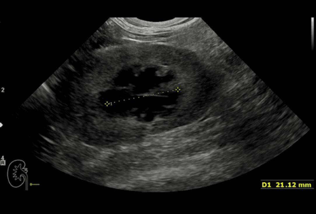 Idronefrosi bilaterale in un gatto: caso clinico